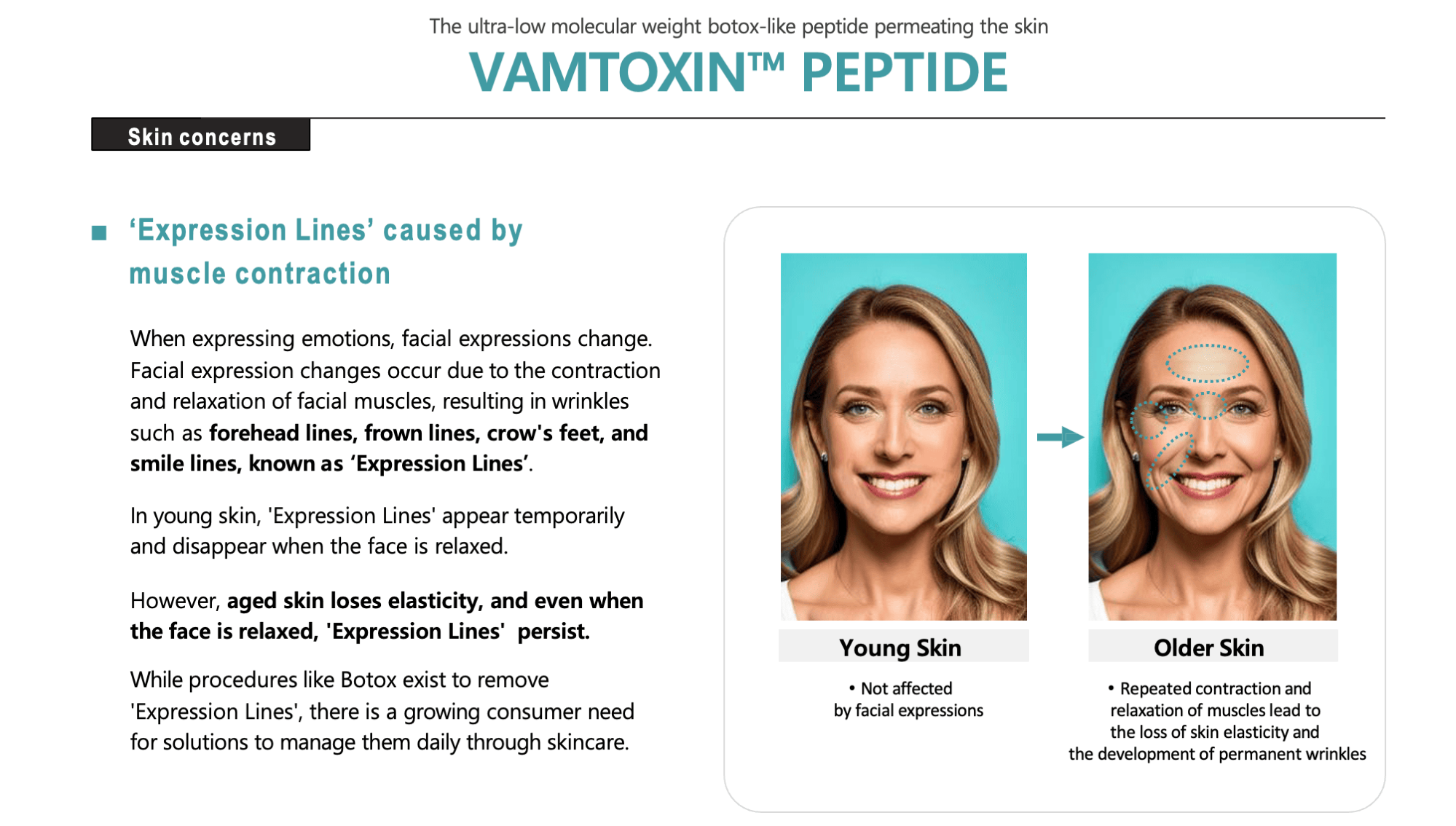 Expression Lines Comparison